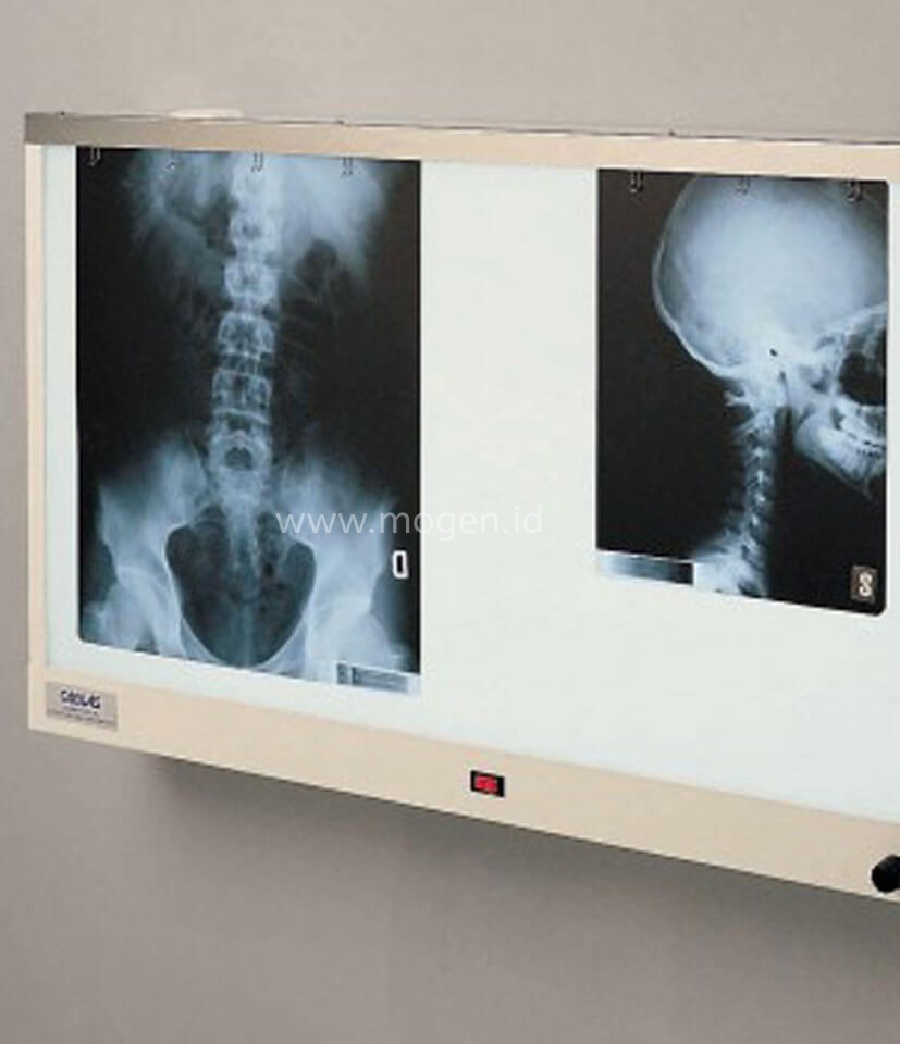 xray-viewer-ink